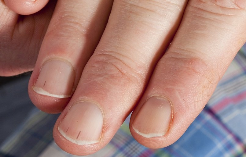 Nail Types: A Guide to Perfect Adhesion and Longevity